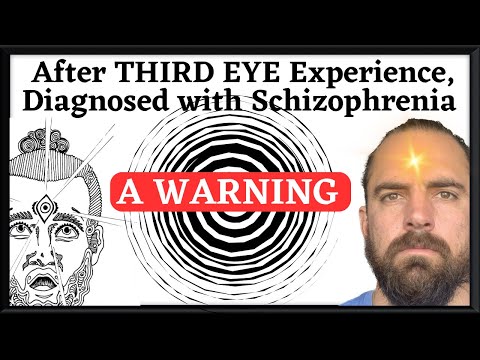 The Third Eye, Schizophrenia & Kundalini Syndrome: I Wasn’t Ready for that Level of Manifestation