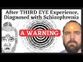 The Third Eye Schizophrenia Kundalini Syndrome I Wasn T Ready For That Level Of Manifestation