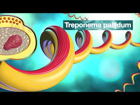 Çfarë është dhe si ngjitet Sifilizi - "Kuriozitete e këshilla mbi shëndetin"