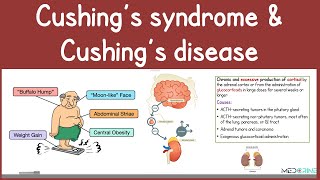 Cushing’s Syndrome vs Cushing’s Disease | Causes, Diagnosis, Symptoms, Diagnosis & Interventions