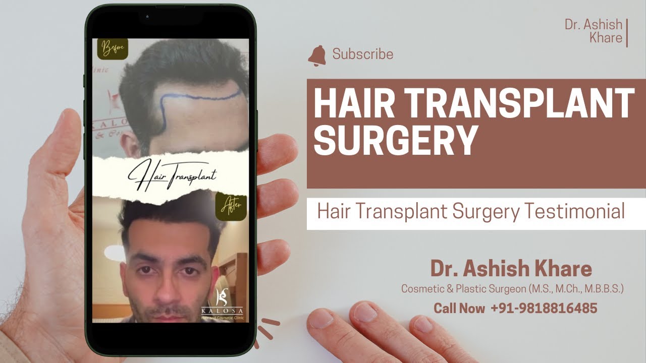 Hair Transplant Review