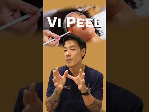 What is the Vi Peel?