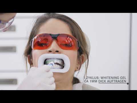 Wie funktioniert ein Bleaching (professionelle Zahnaufhellung) Schritt für Schritt!