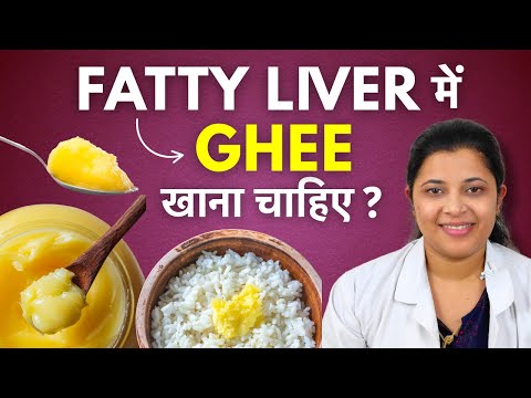 Can we eat ghee in fatty liver? Ghee is the enemy of liver?!