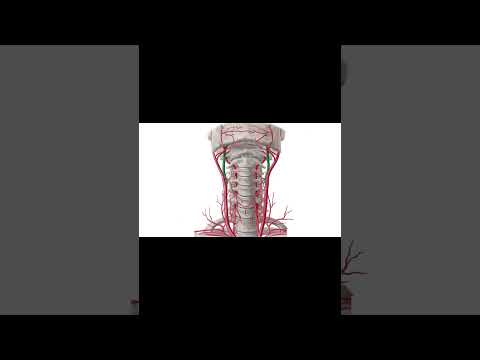 Anatomy of a Decapitation