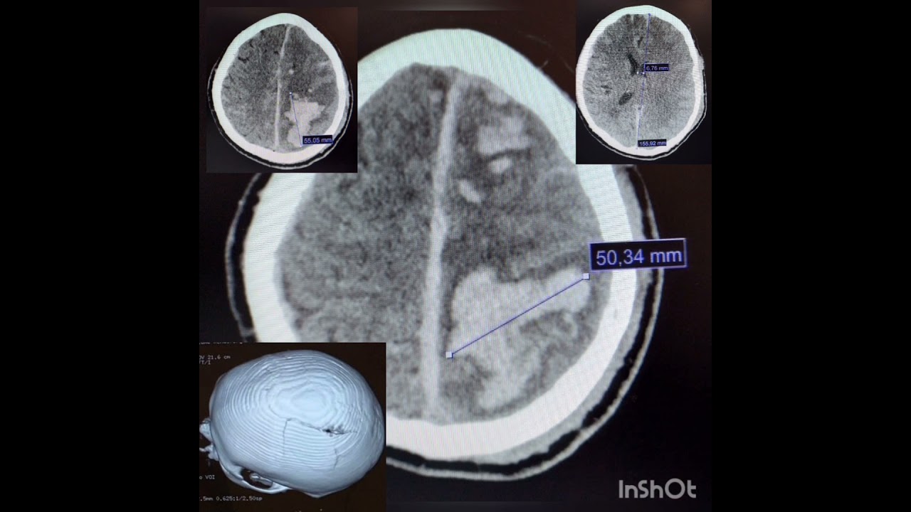 Alejandro Villaseñor Maldonado-48
