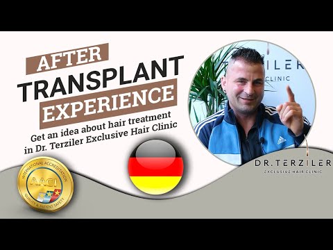 Real hair transplant Turkey patient review video result at Dr. Terziler Exclusive Clinic