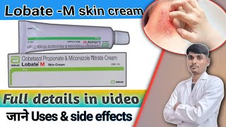 Lobate M cream || Lobate m cream uses & side effects || Antifungal cream || #fungalinfection