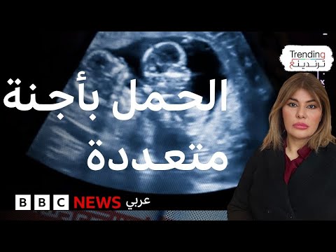 فيديو | الحمل بأجنة متعددة.. ما مخاطره وما طرق علاجه؟