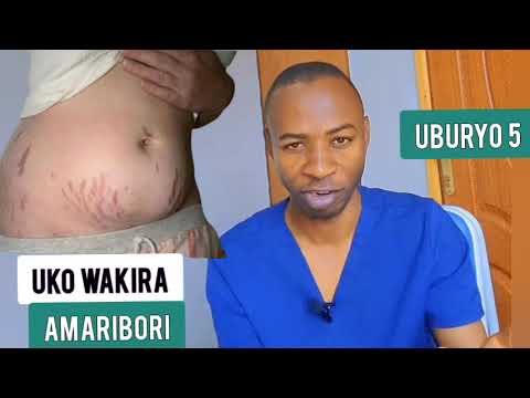 DORE UBURYO 5 BWAGUFASHA GUKIRA AMARIBORI BURUNDU