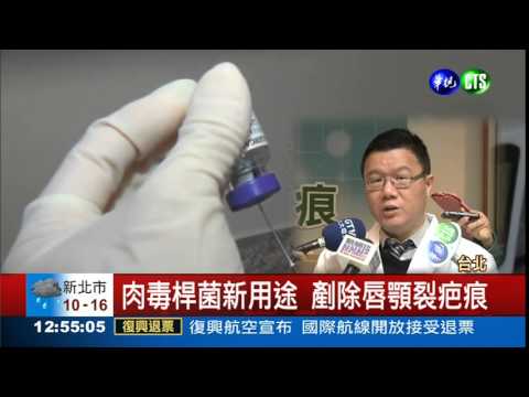 不只除皺 肉毒桿菌可除疤!