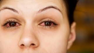 Effective Home Remedy For Red Eyes Is Artificial Tear - How To Use
