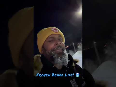 Frozen Beard in the -12°C Arctic Circle | Tromsø, Norway