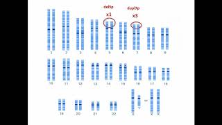 Caso clínico. Citogenética y microalteraciones cromosómicas - Biología Celular y Tisular