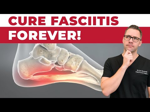 How To Cure Plantar Fasciitis FAST & FOREVER [Heel Pain & Heel Spurs]