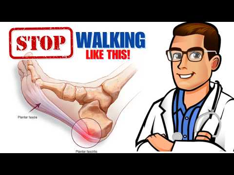 What not to do with plantar fasciitis What is plantar fasciitis