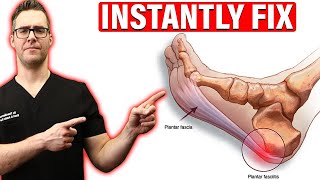 How To Cure Plantar Fasciitis FAST & FOREVER H