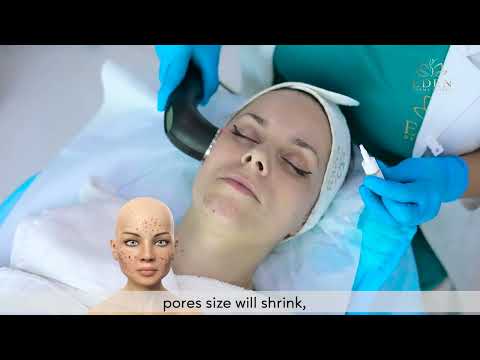 𝗣𝗛𝗢𝗧𝗢𝗗𝗜𝗡𝗔𝗠𝗜𝗖 𝗹𝗮𝘀𝗲𝗿 𝗣𝗗𝗧