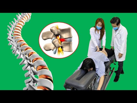 Phòng khám Vật Lý Trị Liệu chuyên điều trị: Thoát vị đĩa đệm - Trượt đốt sống - Đau thần kinh tọa.