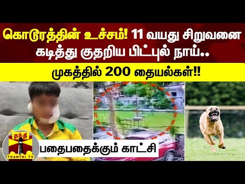 கொடூரத்தின் உச்சம்! 11 வயது சிறுவனை கடித்து குதறிய பிட்புல் நாய்.. முகத்தில் 200 தையல்கள்!!