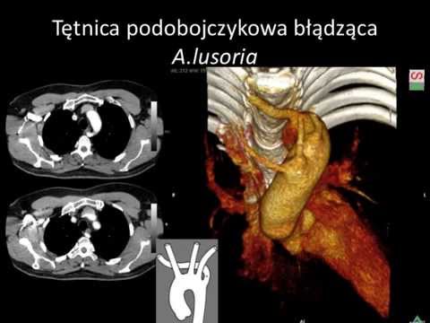 Ćwiczenie mięśni rąk na zdjęciach Węglowodan kulturystyka