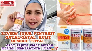 Download lagu REVIEW BEDAK HEROCYN UNTUK GATAL-GATAL KULIT SEMBUH TOTAL⁉️OBAT HERBAL VLOG #herocyn #obatherbal mp3