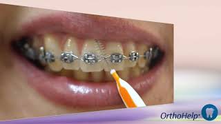 Gota #26 - COMO UTILIZAR A ESCOVA INTERDENTAL