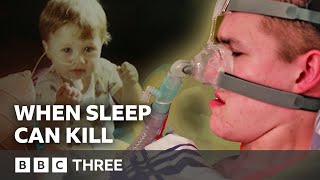 Our Teen Who Dies If He Falls Asleep | Living Differently