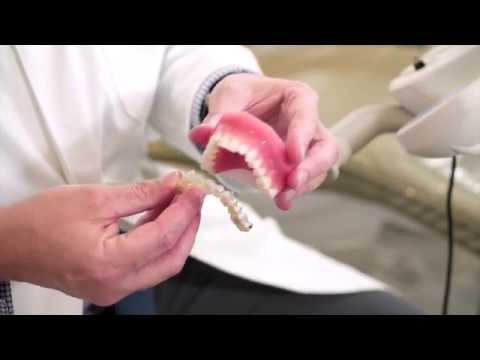 How do Invisalign braces work?