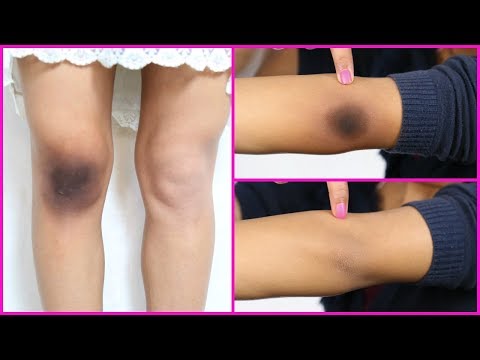 Mal di schiena gastroenterologo Mal di ragazzo di schiena