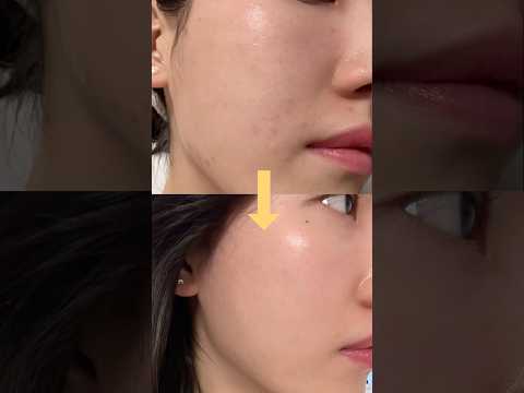 One skincare gadget I can't live without #shorts