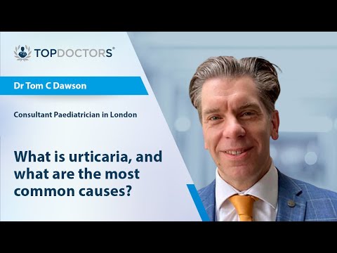 What is urticaria, and what are the most common causes? - Online interview