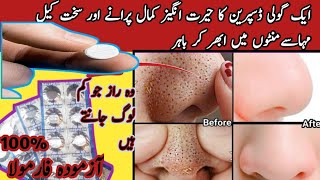 How To Remove BLACKHEADS at Home| In Just 5 Mints Best Way to Remove BLACKHEADS With Desprine||