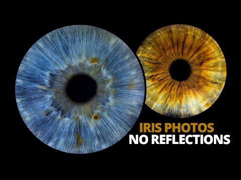 Professional eye photography tutorial | Iris photos with no reflections!
