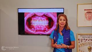 Case Study: Full Mouth Rehabilitation