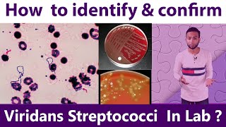 How to identify & Confirm Viridans Streptococci