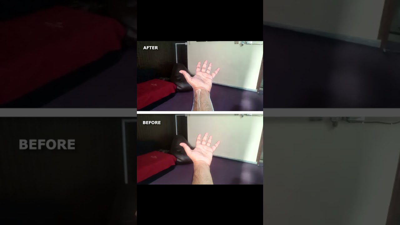 AI VFX Magic: Turning Phone Footage into Realistic AR X-Ray (Seedance 2.0 + RunwayML)