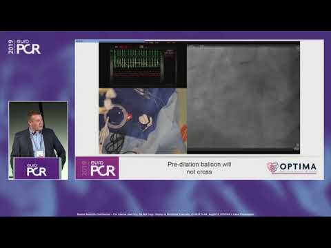 SYNTAX II Trial: Complex PCI Case in a High-Risk Patient