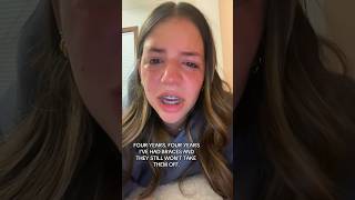 Download lagu If You Have Braces, You NEED To Watch This! 😭🦷 mp3