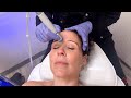 Getting A Hydrafacial At The Dermatology Laser And Vein Center