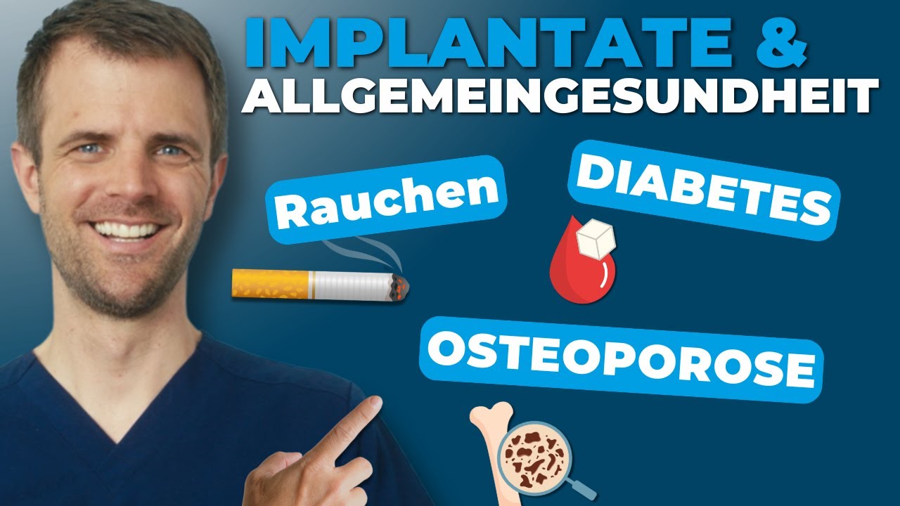 Video-Vorschaubild