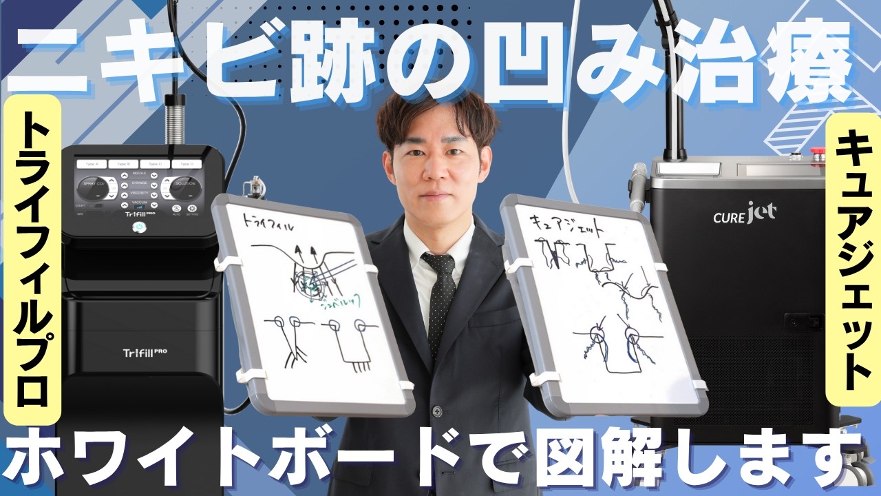 【トライフィルプロ VS キュアジェット】ニキビ跡のクレーター治療の違いを皮膚科専門医がホワイトボードを使って解説します!