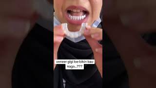 Download lagu Veneer gigi snap on tidak bikin bau mulut #viralvideo #viral #konten #tiktok #veneergigi #gigipalsu mp3