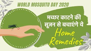 World Mosquito Day: मच्छर काटने की सूजन से बचाएंगे ये उपाय
