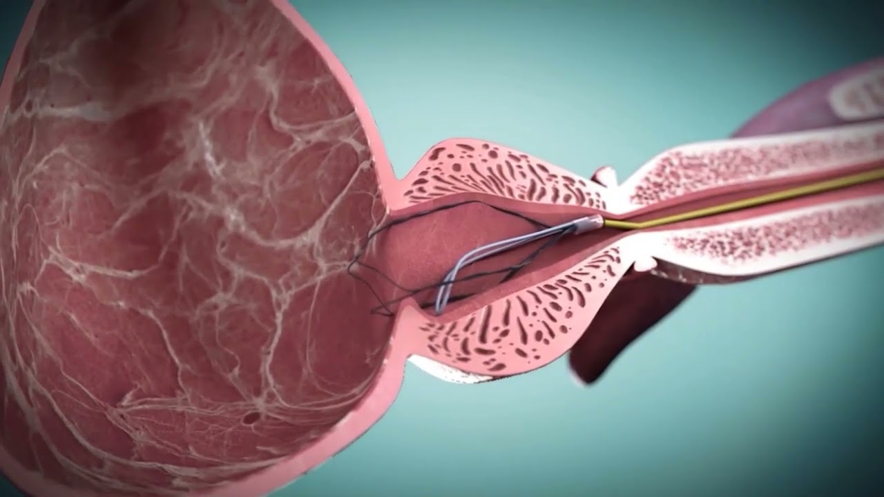 Gedson Evaristo De Santi-27