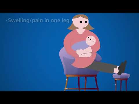 Nottingham University Hospitals NHS Trust Maternity Discharge Video - full video
