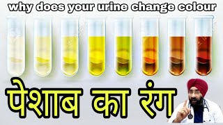पेशाब का रंग | Urine color changed? Know why! DR.EDUCATION (Hindi)