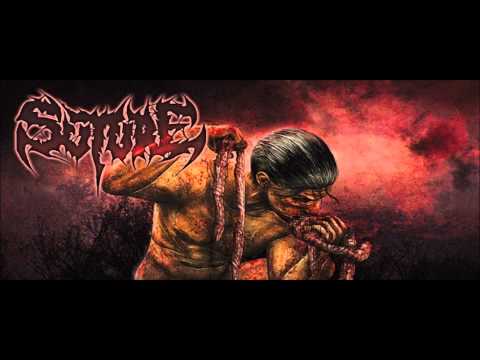 Suture -Bloodsoaked