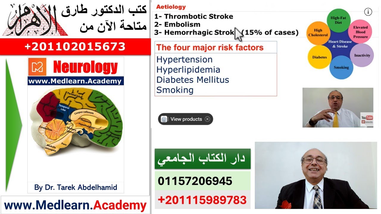 Neurology Stroke (I) - A