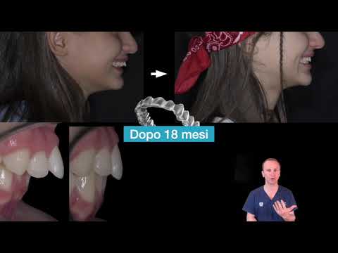 Francesco Martinetti-16